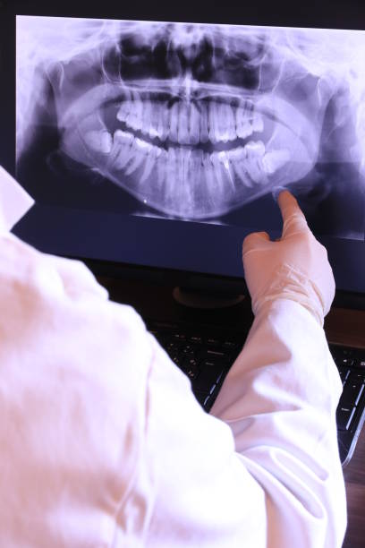 Best Teeth Whitening  in Scotts Valley, CA