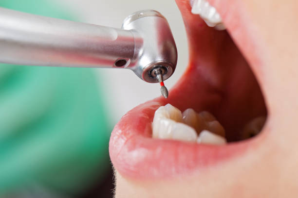 Best Affordable Emergency Dental Care  in Scotts Valley, CA